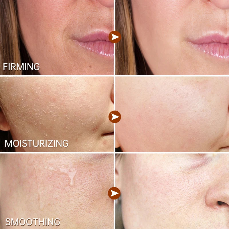 Retinol Face Serum Wrinkle Removal Moisturizing Anti Aging Dark Spots Remover Hyaluronic Acid Facial Serum Skin Care
