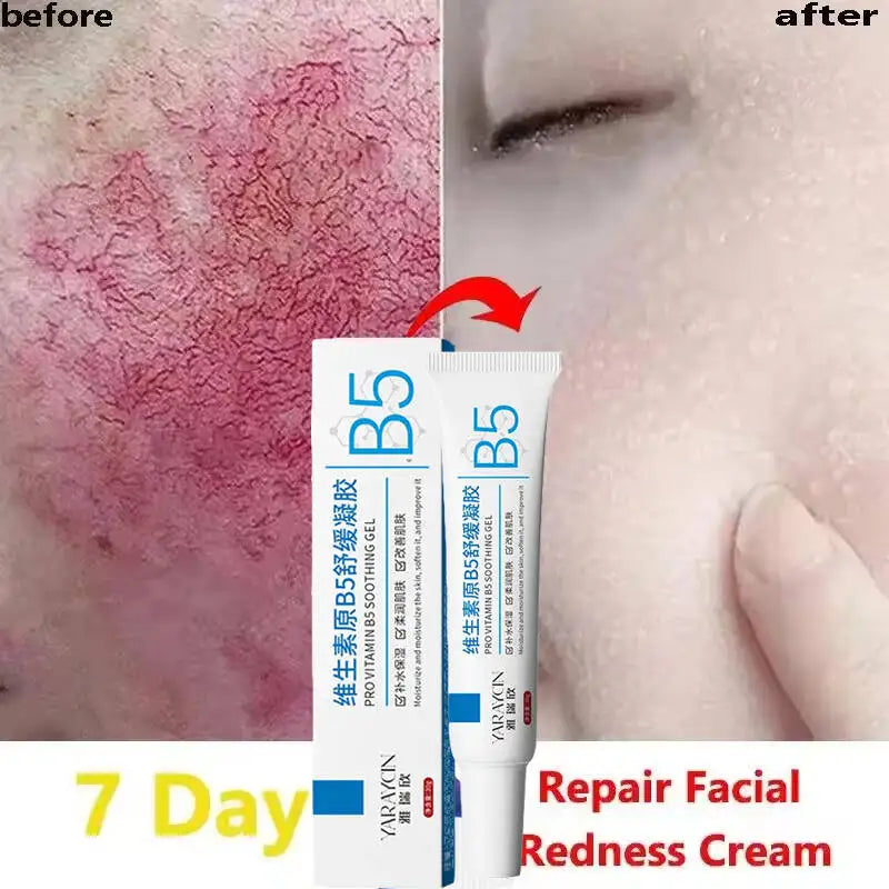 Facial Redness Repair Cream Improve Sensitive Skin Dryness Moisturizer Hydrating Sooth Lotion Removal Rosacea Korean Cosmetics