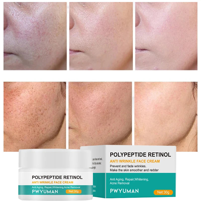 Anti Wrinkle Cream For Face Instant Effect Wrinkle Removal Face Cream Anti-Aging Improve Fine Lines  Nourishing Skin Care 30g