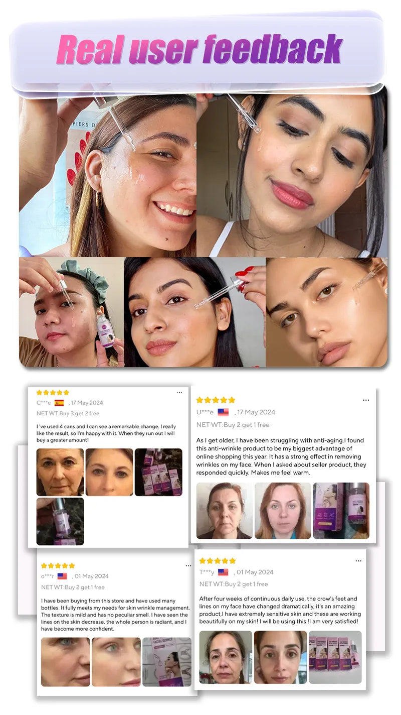 Anti-aging, anti-wrinkle, Remove wrinkles, Lifting firming，moisturizing