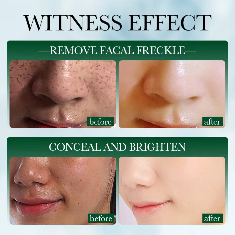 Whitening Cream Private Parts Underarm Bleaching Serum Whiten Butt Knee Brighten Inner Thigh Intimate Parts Dark Remove Melanin