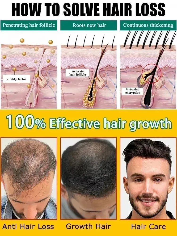 Hair Growth Essential Loss Regrowth Treatment Strengthens Hair Nourishes Scalp Light Weight Non Greasy Improve Scalp Circulation