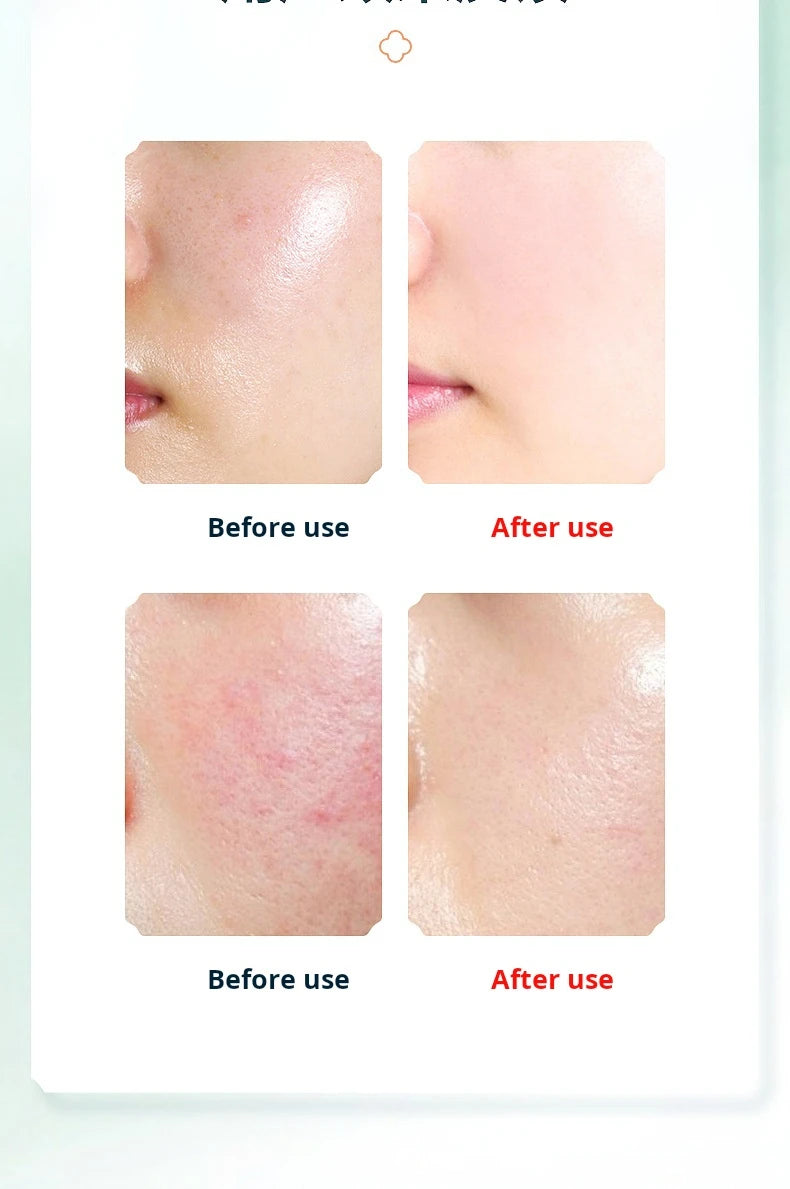 New Warm Feeling Cleanser Pore Blackhead Cleaner Electric Face Washing Instrument Home Facial Eye Hot Massager Beauty Tools