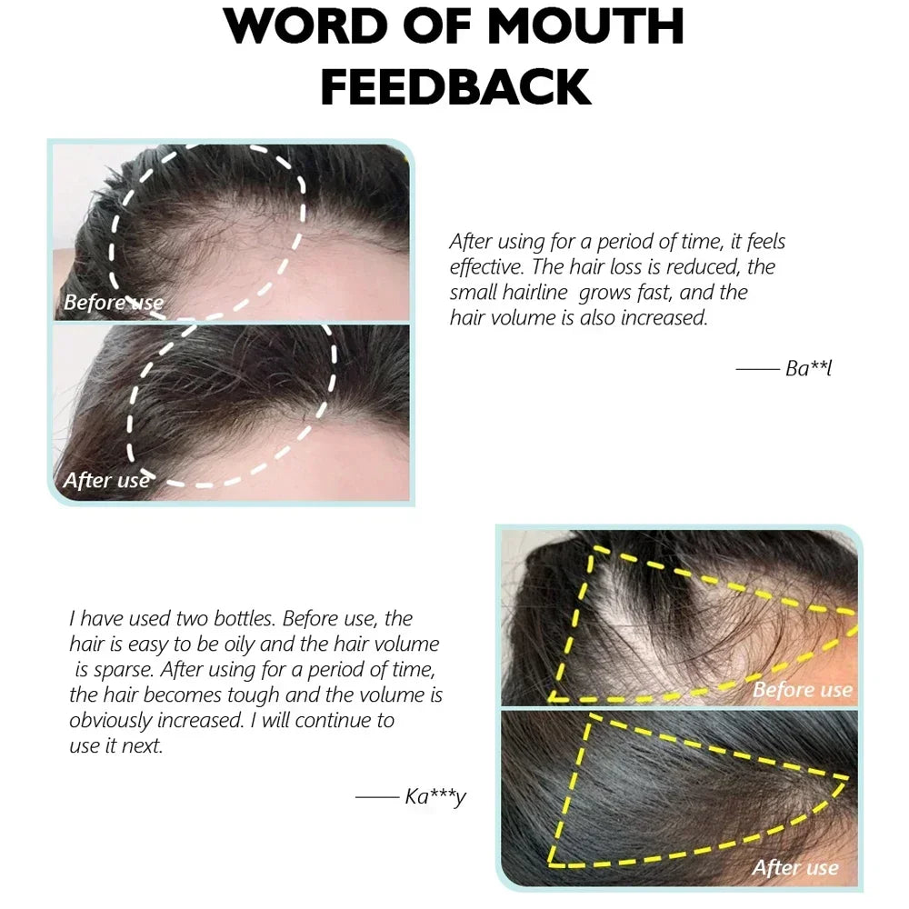99% of buyers buy again, have more and more hair, say goodbye to baldness, thick hair,Hot selling product