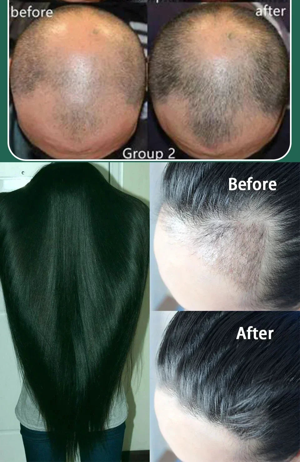99% of buyers buy again, have more and more hair, say goodbye to baldness, thick hair,Hot selling product