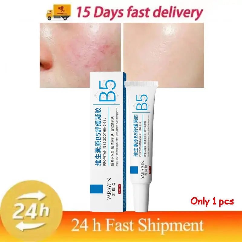 Facial Redness Repair Cream Improve Sensitive Skin Dryness Moisturizer Hydrating Sooth Lotion Removal Rosacea Korean Cosmetics