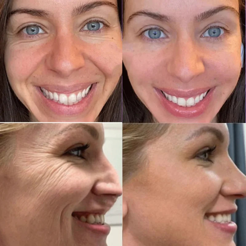 Anti Wrinkle Cream For Face Instant Effect Wrinkle Removal Face Cream Anti-Aging Improve Fine Lines  Nourishing Skin Care 30g