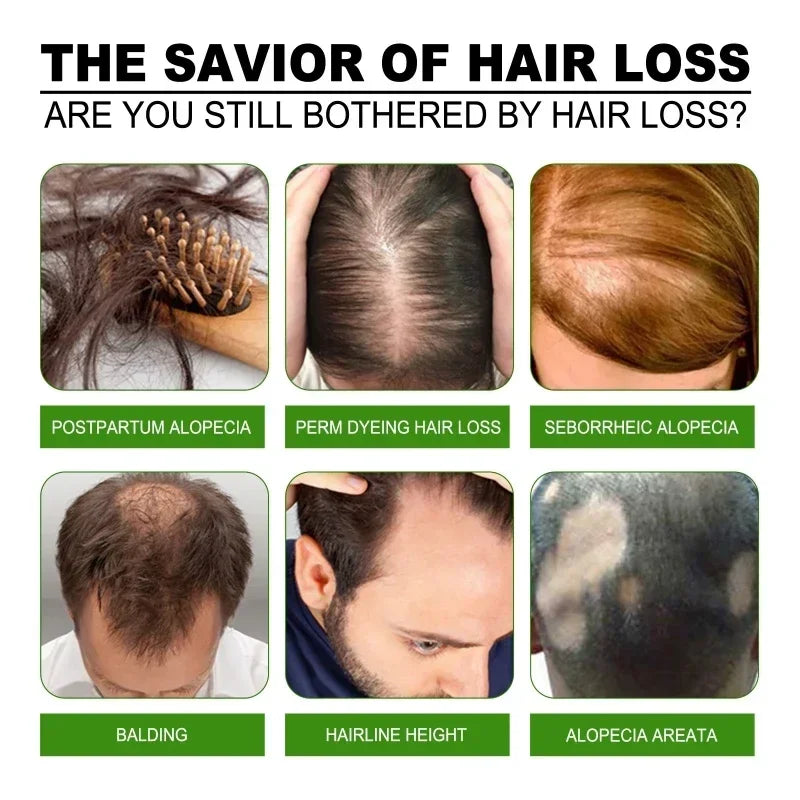 99% of buyers buy again, have more and more hair, say goodbye to baldness, thick hair,Hot selling product